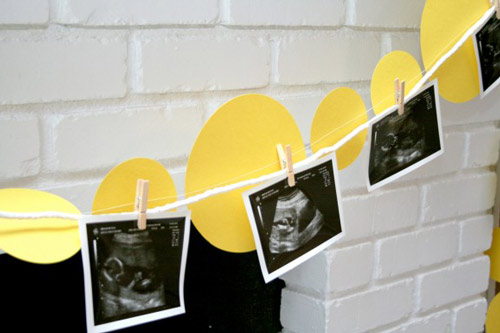 yellow circles and ultrasound picture garland